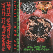 Open Sores And Infected Appendages