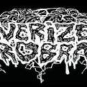 Pulverized Necrobrains