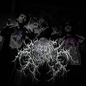 Epileptic Avulsions (Re-Recording)