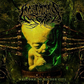 Gore Gore Gadget by Annotations Of An Autopsy