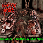 Obsession with Disemboweled Human Pieces