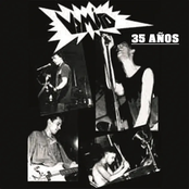 Vomito 35 Años