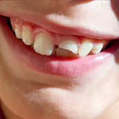 Swimming Paul: Smiling Through The Pain 2