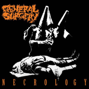 General Surgery: Necrology - Reissue