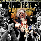 Epidemic Of Hate by Dying Fetus