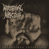 Intestinal Infection
