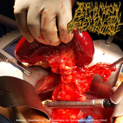 Medical Disorders of the Functions in the Gastrointestinal Tract