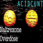 Naltrexone Overdose