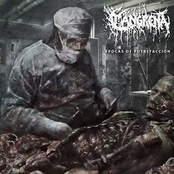 Épocas De Putrefacción