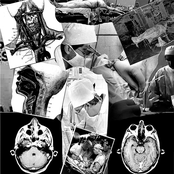 High-Frequency Ventilation