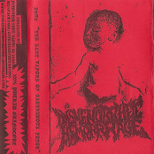 The Last Vapors of Gangrenous Fetor