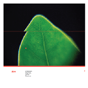 Circadian Rhythm, Sleep Disorder