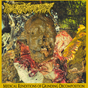Medical Renditions of Grinding Decomposition