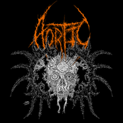 Aortic