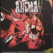 Hypoxiatometmyo Blabglobulin Lymphopsytacsis Regain