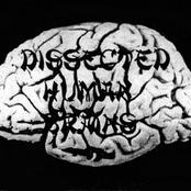 dissected human brains