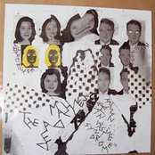 Human Brain Wasting Syndrome