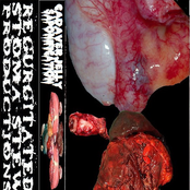 Cadaverjelly Saponification / Black Market Organ Donor