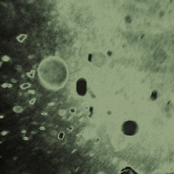 Post-Traumatic Stress Disorder