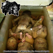 Aborted Fetuses Marinating In Formaldehyde