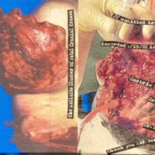 The Infinite Slumber Of Fatal Cranial Trauma