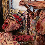 Trepanación