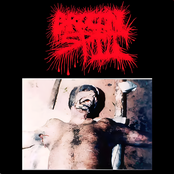 Myiasis Filled Cephalon