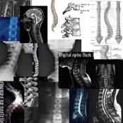 Digital spine flush 1