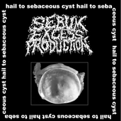 Hail to Sebaceous Cyst!