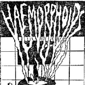 Haemorrhoids