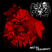 Metal Trauma!!!