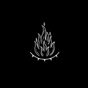 Limbs - Bones