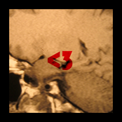 L.O.V. EP