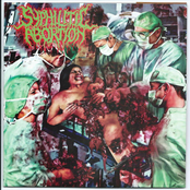 Expurgo / Syphilitic Abortion