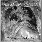 Thoracalgia