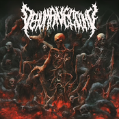 Dehumanectomy