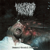 Buzzsaw Cranial Fixation