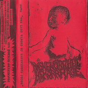 Last Vapors of Gangrenous Fetor