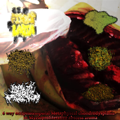 6 Way Occipitotemporal Metaphyseal Chondrodysplasia in Myeloproliferative Abscess Aroma