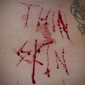 Thin Skin