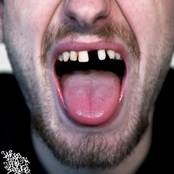 Drugs Booze & Dental Issues