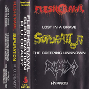 Fleshcrawl / Supuration / R.U. Dead? (Split)