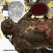 Sangiopurulent Cadaveric Escavation Of Necrosified Dysfunctional Pulmonary Gastriciosis