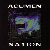 Sutures by Acumen Nation