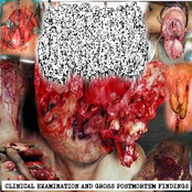 Clinical Examination and Gross Posmortem Findings
