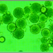 Brunch: meal of the elite