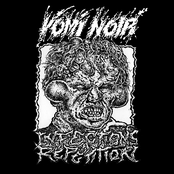 Infections à Répétition