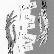 Gnarled Veins & Varicose Pains