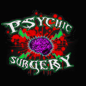 Psychic Surgery