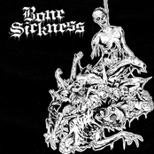 Bone Sickness